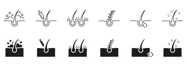مزوتراپی
